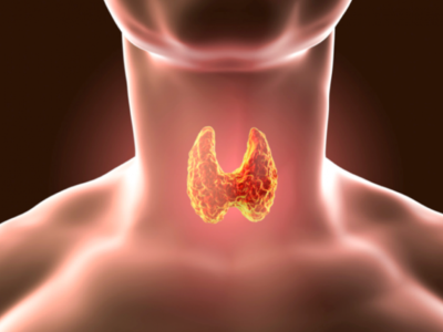 Haşitomo hastalığı çocuk ve ergenlerde tiroid fonksiyon bozukluğunun en sık nedenidir. Guatr, yaşa göre tiroid bezinin büyük olmasını ifade eder. Çok çeşitli nedenlerden dolayı guatr meydana gelir.  
